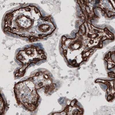 Immunohistochemistry-Paraffin: Laminin gamma 1 Antibody (CL3196) [NBP2-42395]