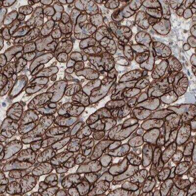 Immunohistochemistry-Paraffin: Laminin gamma 1 Antibody (CL3196) [NBP2-42395]
