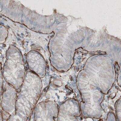 Immunohistochemistry-Paraffin: Laminin gamma 1 Antibody (CL3196) [NBP2-42395]