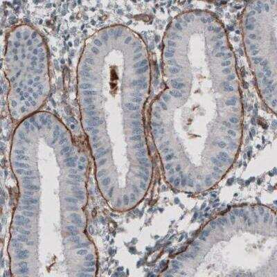 Immunohistochemistry-Paraffin: Laminin gamma 1 Antibody (CL3196) [NBP2-42395]