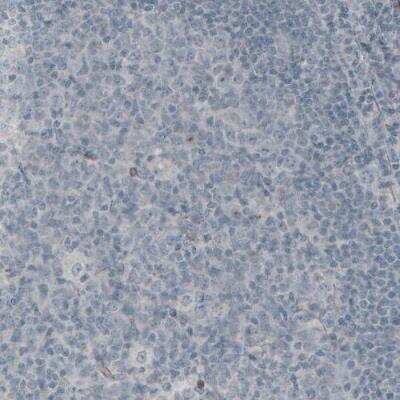 Immunohistochemistry-Paraffin: Laminin gamma 1 Antibody (CL3196) [NBP2-42395]