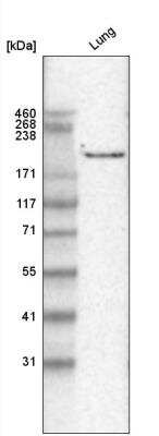 Western Blot: Laminin gamma 1 Antibody (CL3196) [NBP2-42395]