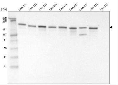 Western Blot: Laminin gamma 1 Antibody (CL3196) [NBP2-42395]