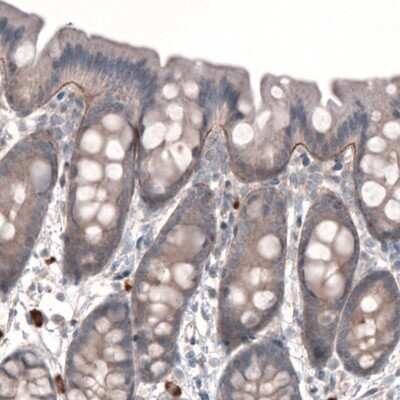 Immunohistochemistry-Paraffin: Laminin gamma 1 Antibody (CL3199) [NBP2-42396]