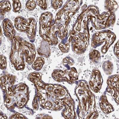 Immunohistochemistry-Paraffin: Laminin gamma 1 Antibody (CL3199) [NBP2-42396]