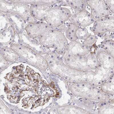 Immunohistochemistry-Paraffin: Laminin gamma 1 Antibody (CL3199) [NBP2-42396]