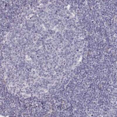 Immunohistochemistry-Paraffin: Laminin gamma 1 Antibody (CL3199) [NBP2-42396]