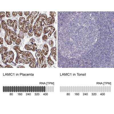 Immunohistochemistry-Paraffin: Laminin gamma 1 Antibody (CL3199) [NBP2-42396]