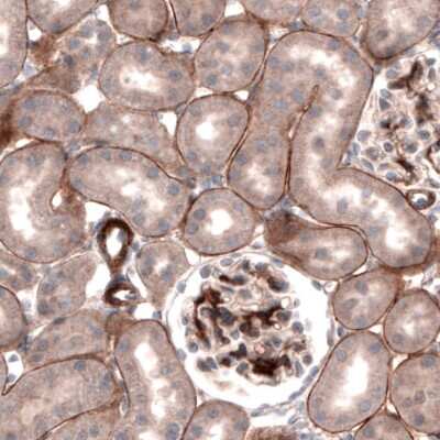 Immunohistochemistry-Paraffin: Laminin gamma 1 Antibody (CL3199) [NBP2-42396]