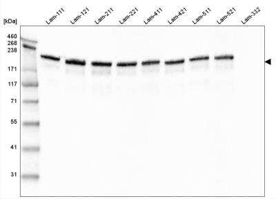 Western Blot: Laminin gamma 1 Antibody (CL3199) [NBP2-42396]