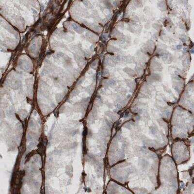 Immunohistochemistry-Paraffin: Laminin gamma 1 Antibody (CL3201) [NBP2-42397]