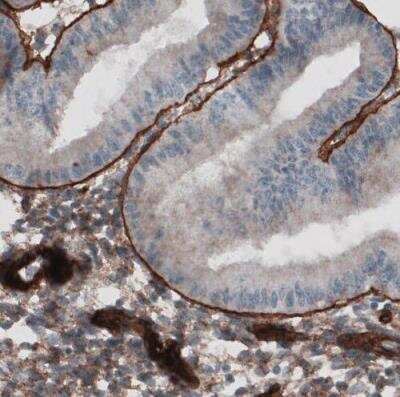 Immunohistochemistry-Paraffin: Laminin gamma 1 Antibody (CL3201) [NBP2-42397]