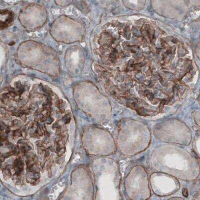 Immunohistochemistry-Paraffin: Laminin gamma 1 Antibody (CL3201) [NBP2-42397]