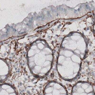 Immunohistochemistry-Paraffin: Laminin gamma 1 Antibody (CL3201) [NBP2-42397]