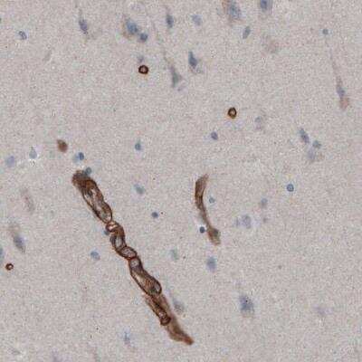 Immunohistochemistry-Paraffin: Laminin gamma 1 Antibody (CL3201) [NBP2-42397]