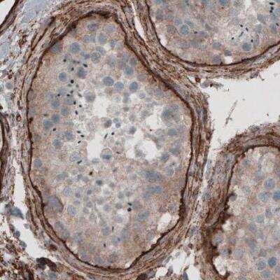 Immunohistochemistry-Paraffin: Laminin gamma 1 Antibody (CL3201) [NBP2-42397]