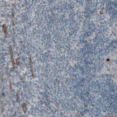 Immunohistochemistry-Paraffin: Laminin gamma 1 Antibody (CL3201) [NBP2-42397]