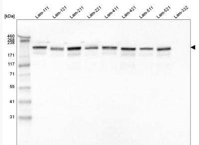 Western Blot: Laminin gamma 1 Antibody (CL3201) [NBP2-42397]