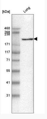 Western Blot: Laminin gamma 1 Antibody (CL3201) [NBP2-42397]