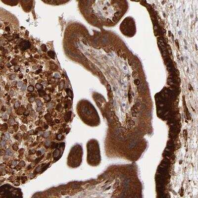 Immunohistochemistry: Laminin gamma 1 Antibody [NBP1-87719]