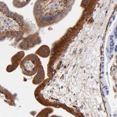 Immunohistochemistry-Paraffin: Laminin gamma 1 Antibody [NBP1-87718]