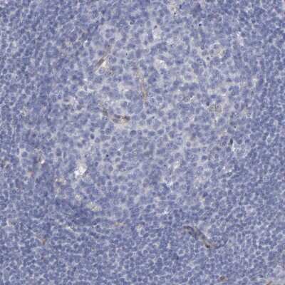 Immunohistochemistry-Paraffin: Laminin gamma 1 Antibody [NBP1-87718]