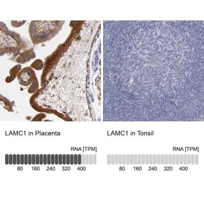 Immunohistochemistry-Paraffin: Laminin gamma 1 Antibody [NBP1-87718]