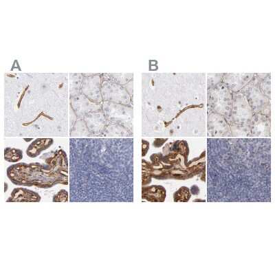 Immunohistochemistry-Paraffin: Laminin gamma 1 Antibody [NBP1-87718]