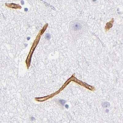 Immunohistochemistry-Paraffin: Laminin gamma 1 Antibody [NBP1-87718]