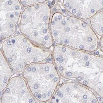 Immunohistochemistry-Paraffin: Laminin gamma 1 Antibody [NBP1-87718]