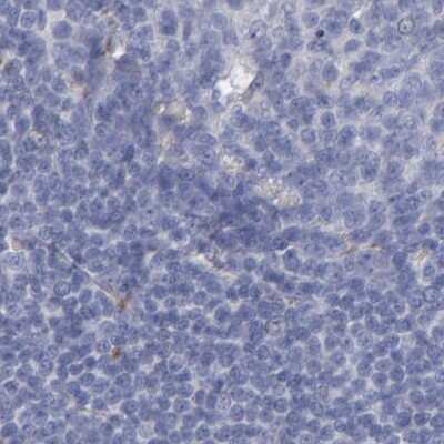 Immunohistochemistry-Paraffin: Laminin gamma 1 Antibody [NBP1-87718]