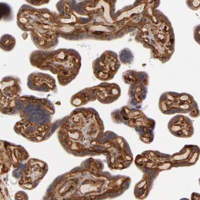 Immunohistochemistry-Paraffin: Laminin gamma 1 Antibody [NBP1-87719]