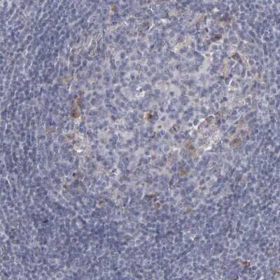 Immunohistochemistry-Paraffin: Laminin gamma 1 Antibody [NBP1-87719]