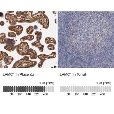 Immunohistochemistry-Paraffin: Laminin gamma 1 Antibody [NBP1-87719]