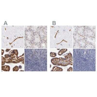 Immunohistochemistry-Paraffin: Laminin gamma 1 Antibody [NBP1-87719]