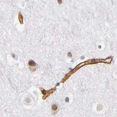 Immunohistochemistry-Paraffin: Laminin gamma 1 Antibody [NBP1-87719]