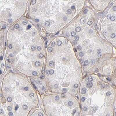Immunohistochemistry-Paraffin: Laminin gamma 1 Antibody [NBP1-87719]