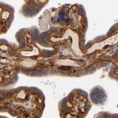 Immunohistochemistry-Paraffin: Laminin gamma 1 Antibody [NBP1-87719]