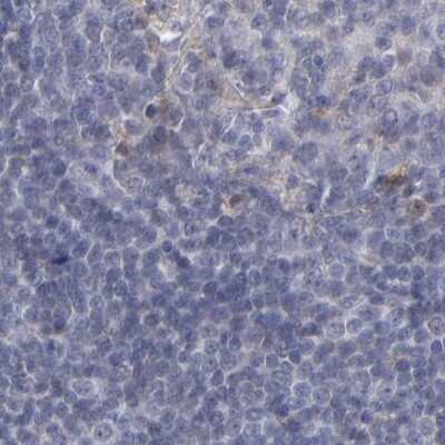 Immunohistochemistry-Paraffin: Laminin gamma 1 Antibody [NBP1-87719]