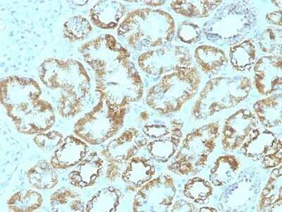 Immunohistochemistry-Paraffin: Laminin gamma 1 Antibody (SPM193) - IHC-Prediluted [NBP2-48137]