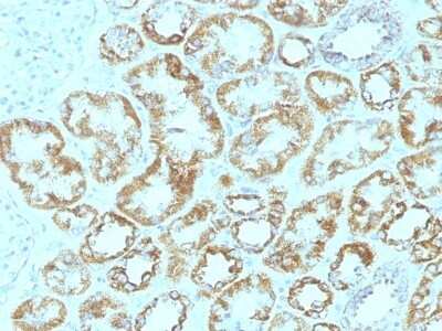 Immunohistochemistry-Paraffin: Laminin gamma 1 Antibody (SPM193) [NBP2-44752]