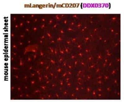 Immunocytochemistry/ Immunofluorescence: Langerin/CD207 Antibody (205C1) [DDX0370P-100]