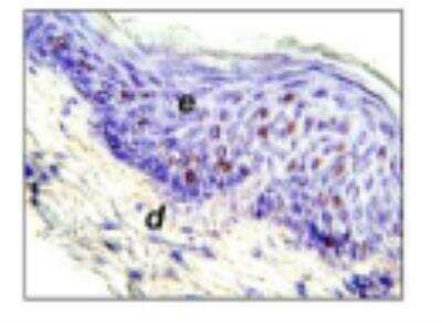 Immunohistochemistry: Langerin/CD207 Antibody (306G9) [DDX0368P-100]