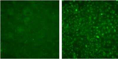 Immunocytochemistry/ Immunofluorescence: Langerin/CD207 Antibody (310F7.02) [DDX0361P-100]
