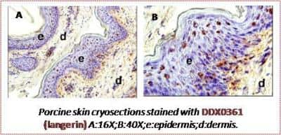 Immunohistochemistry-Paraffin: Langerin/CD207 Antibody (310F7.02) [DDX0361P-100]