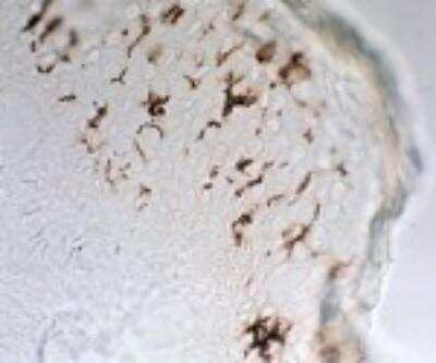 Immunohistochemistry-Paraffin: Langerin/CD207 Antibody (310F7.02) [DDX0361P-100]