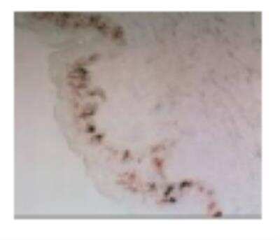 Immunohistochemistry: Langerin/CD207 Antibody (808E10.01) [DDX0360P-100]