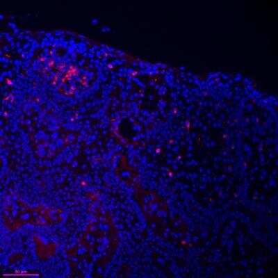 Immunohistochemistry-Frozen: Langerin/CD207 Antibody (923B7) [DDX0373P-100]