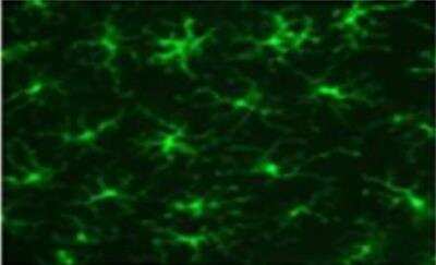 Immunocytochemistry/ Immunofluorescence: Langerin/CD207 Antibody (929F3.01) [DDX0362P-100]