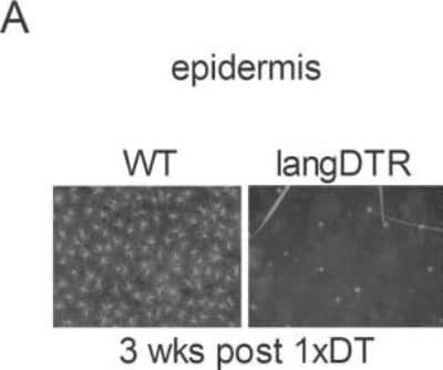 Immunohistochemistry: Langerin/CD207 Antibody (929F3.01) [DDX0362P-100]